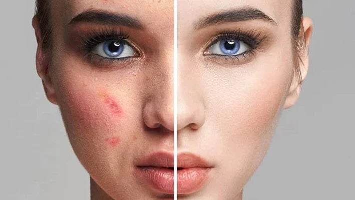 SkinGlow Base - Fundación Mágica